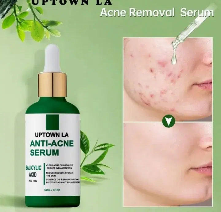 Anti-Acne Face Serum