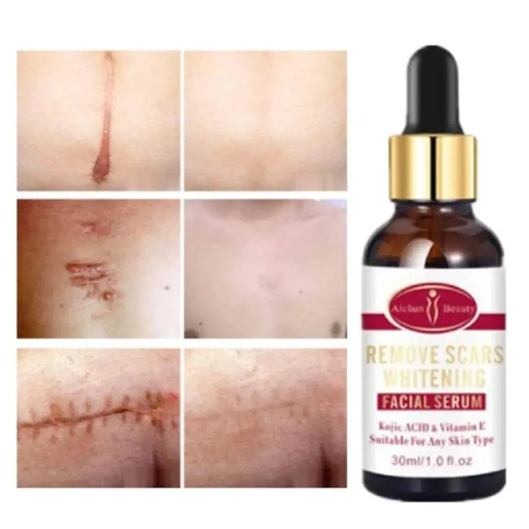 Scar Removal Facial Serum | Moisturizing with Kojic Acid & Vitamin E